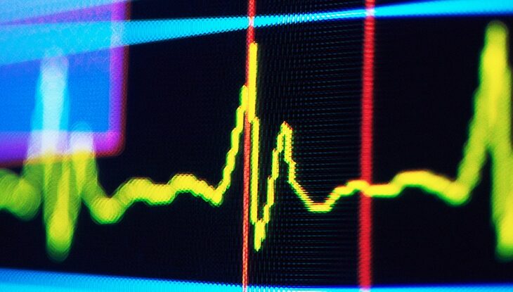 Технології - Ритм у пульсі людини може сигналізувати про майбутнє когнітивне погіршення