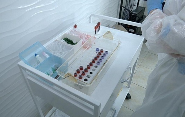 Новини України - У Києві зафіксовано 83 випадки захворювання на гепатит А