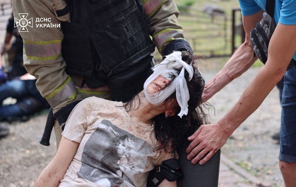 Новини України - ООН назвала число жертв російських атак в травні