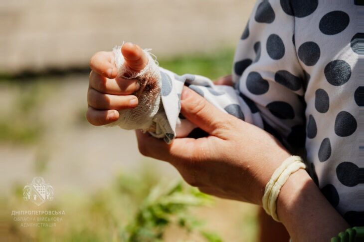 Новини України - У Дніпрі зросла кількість жертв ракетної атаки