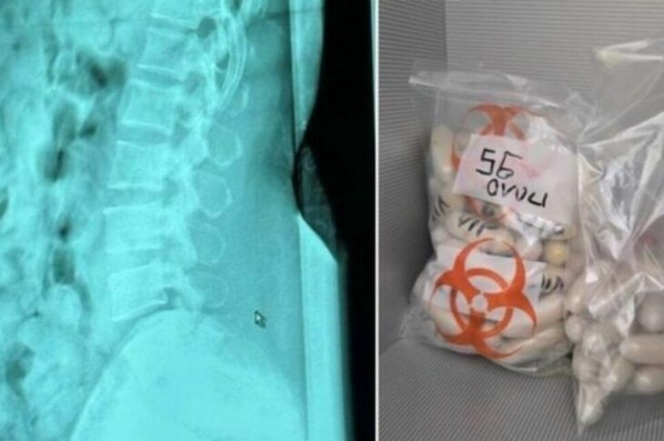 Новини світу - В Італії затримано жінку з 1,4 кг героїну в шлунку